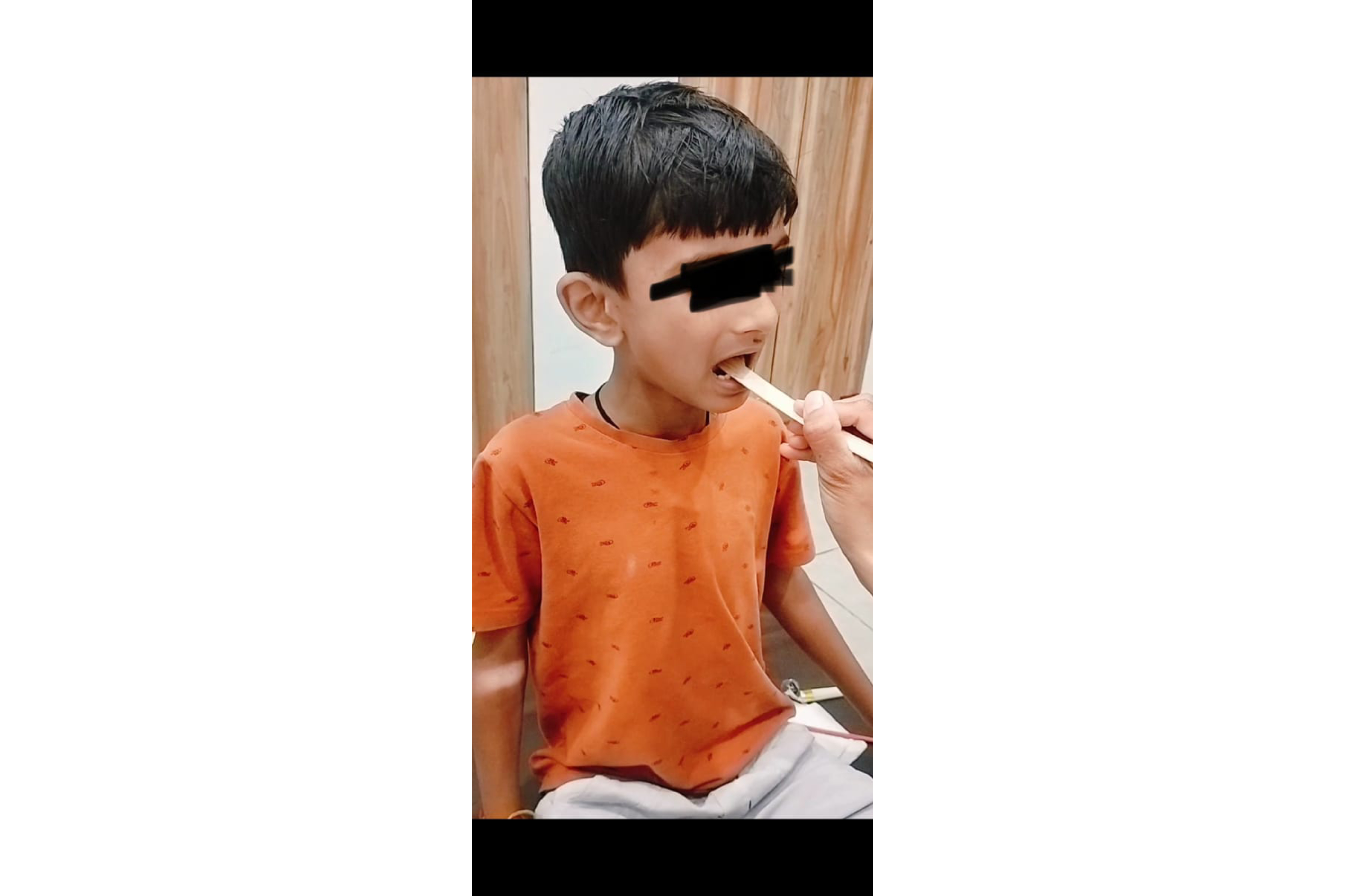 Oral Placement Therapy 2